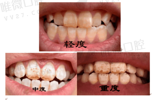 11. 成都高德口腔