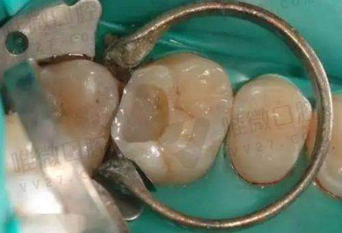 4、柳州仁爱口腔门诊部
