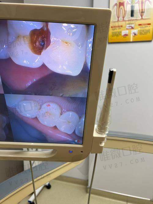 6、柳州市工人医院口腔科