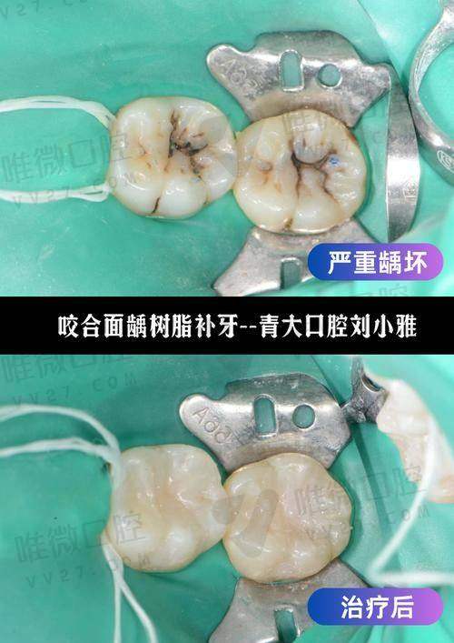 1、柳州蓝天口腔