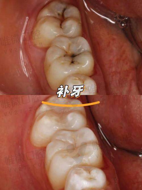 结语