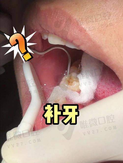 一、柳州市补牙便宜又好的医院排名前十名单预览