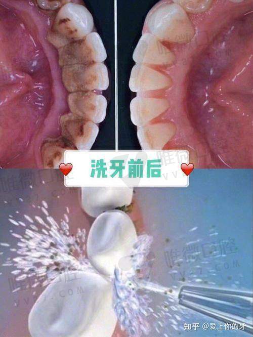 正规牙科医院24小时在线询问靠谱吗？