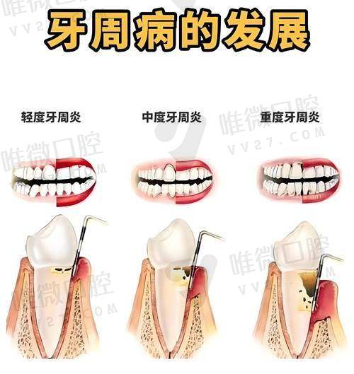 牙齿项目常见价格区间参考（2025年各城市民营口腔均价）