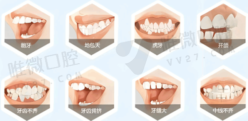 唐山壹颗芽口腔怎么样？种植牙、正畸患者真实案例告诉你答案！