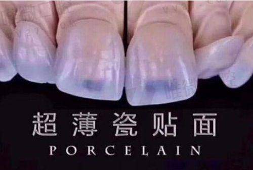 劲松口腔值得去的理由还在于他们“用心”