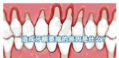 五店联动，通用价格！矫正项目限时直降高达30%