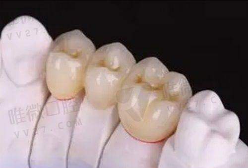 儿童齿科