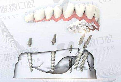 环境特别棒，看牙就像咖啡厅一样轻松舒心
