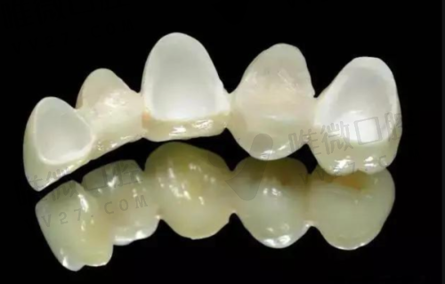 沈阳盛大口腔补牙、拔牙、洗牙：价格公开透明，看牙也不贵
