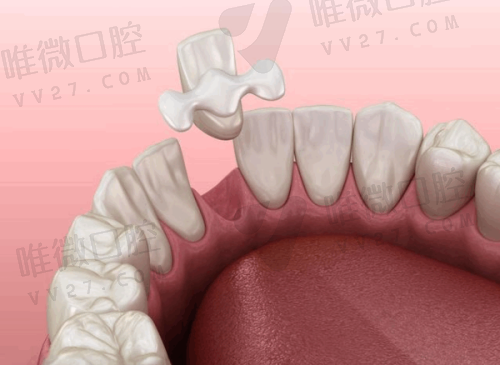 壹心维美口腔