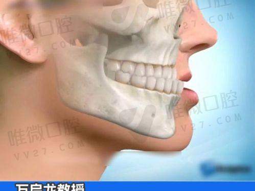 二、正颌手术医生详细介绍&医院技术实力解析