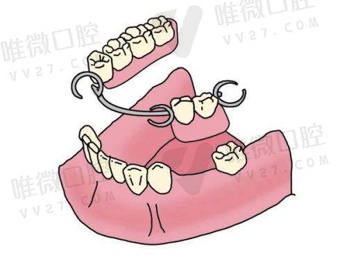 深圳瑞致口腔门诊部怎么样？正规资质、特色项目与优质服务揭秘！