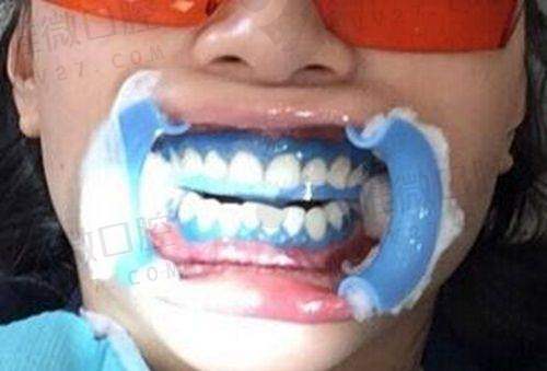 6. 固原罗秉兰口腔诊所