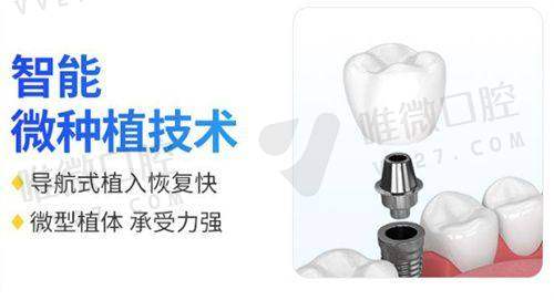 价格透明的背后：流程设计也特别讲究