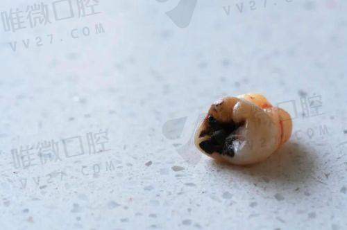 六、急诊处理费用及注意事项
