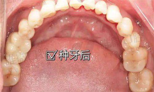 10、南通通州美新口腔