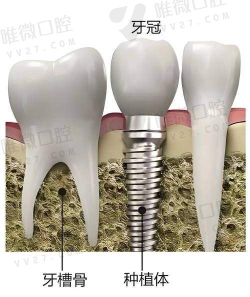 5、南通启东植得口腔