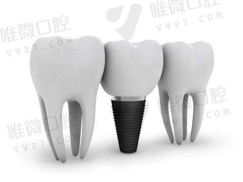 环境能提升种牙体验吗？