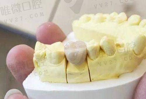 同济大学附属口腔医院:轻质灵活型活动假牙研发标杆