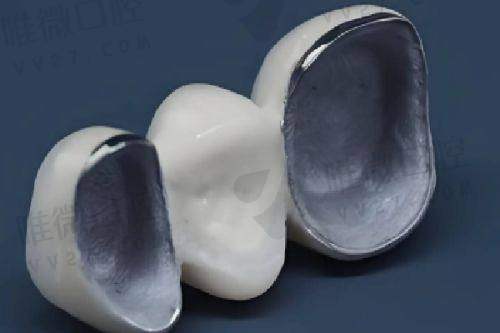 新华医院口腔科:老年&儿童活动假牙标杆