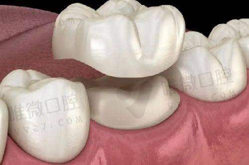 复旦大学附属中山医院口腔科:综合医院中的修复实力派