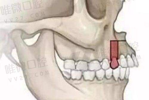 大连齿医生口腔矫正牙齿行不行?成人儿童都能安排得明白