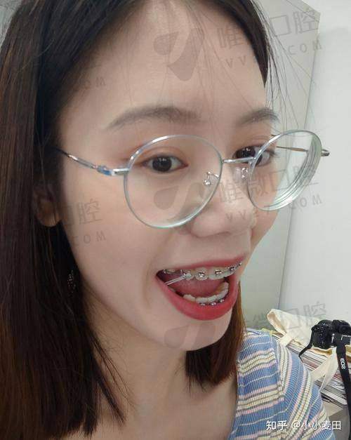 价格透明得像玻璃