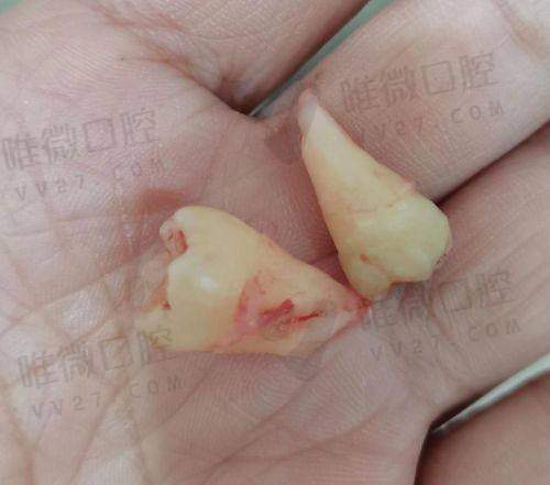 矫正牙齿哪家强?正畸界的昆仑派高手