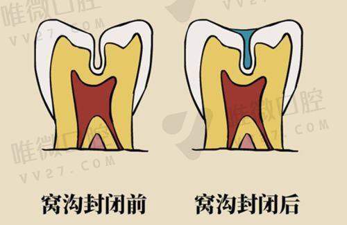 百年老院的