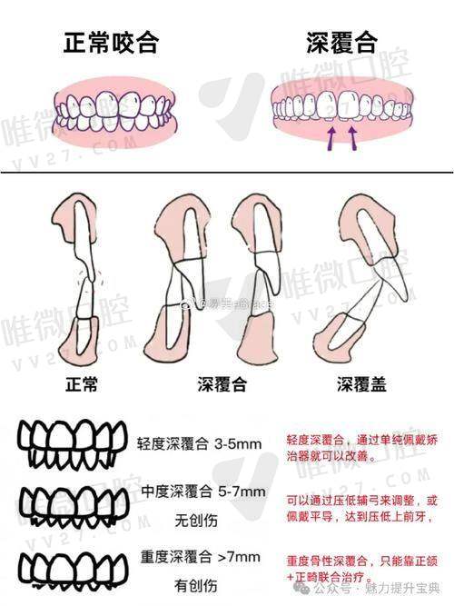 中山大学孙逸仙纪念医院口腔科怎么样？实力强、专科地位高，患者好评如潮！