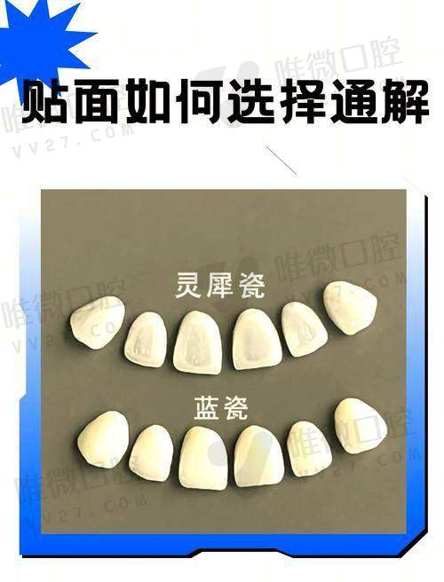 儿童看牙去哪家?这些诊所专治熊孩子