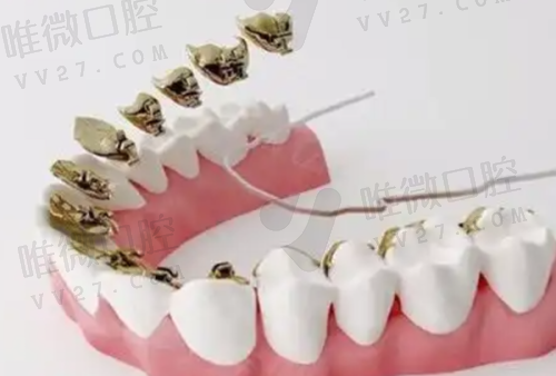牙体牙髓治疗