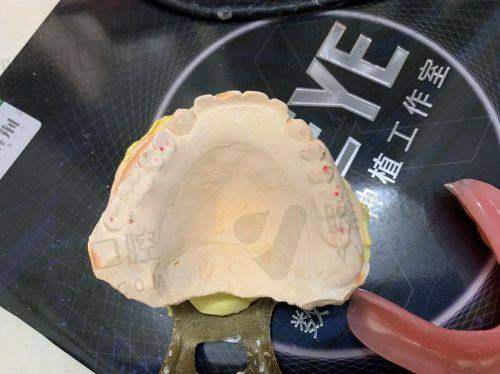 我该如何选择适合自己的方案？