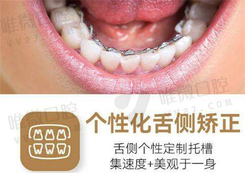 费用部分你得知道的那些事