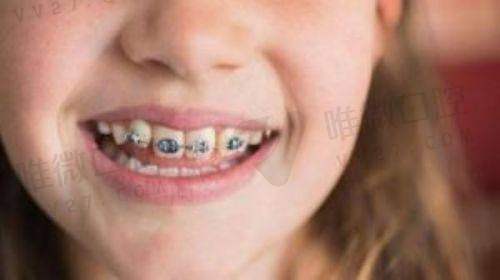 揭阳诺贝尔口腔医院医生团队专精靠谱，看牙不怕“踩坑”