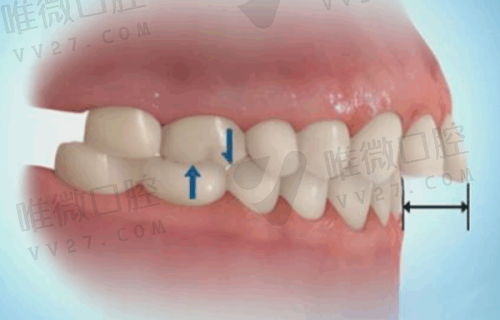 重庆协尔口腔诊所怎么样?医生态度好动作轻,正畸种植项目超齐全