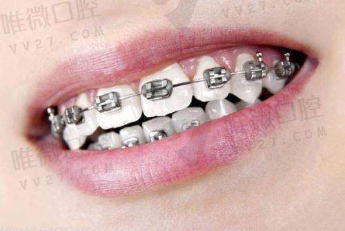 关于儿童口腔：泰州常见儿牙治疗费用