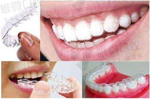 石家庄植美口腔：专注美学种植，修复你那“一口好牙”