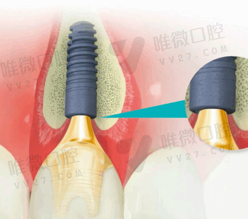 石家庄永齐口腔：老品牌、医生经验多