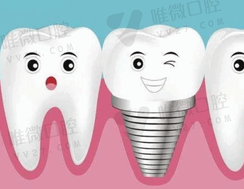 泰州种植牙价格全解析：品牌型号价差大，你选对了吗？
