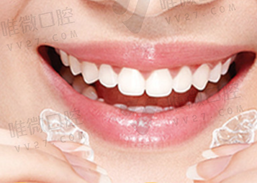 赤峰美加口腔种植牙多少钱一颗?顺便聊聊赤峰雅美口腔那些事