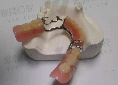 福清维乐口腔门诊部怎么样预约挂号