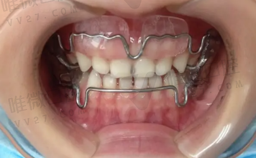 杭州萧山余锦军口腔诊所收费价格表2026