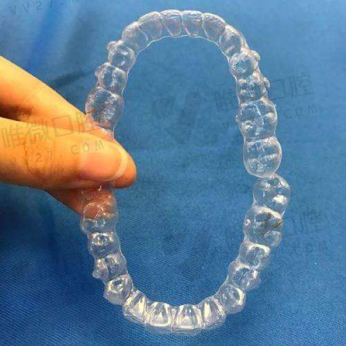 福清维乐口腔门诊部收费价格表2026