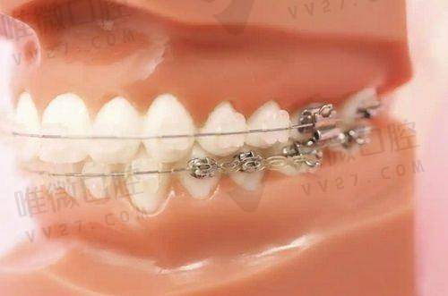 总结：为什么要选择福清维乐口腔门诊部