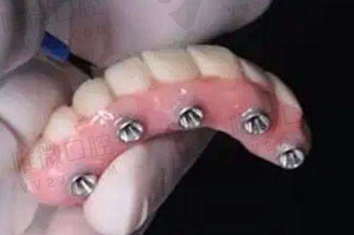 福清维乐口腔门诊部技术优势 环境和服务特色 营业时间