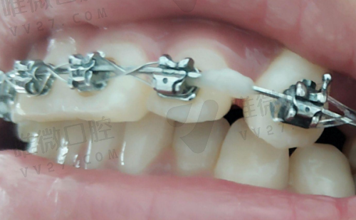 福清维乐口腔门诊部所开展的项目