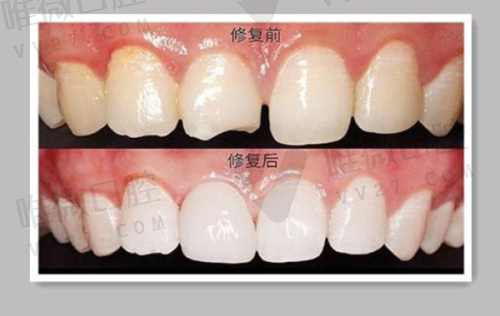 海珠区广大口腔医院地址在哪里？详细地址+交通路线全揭秘
