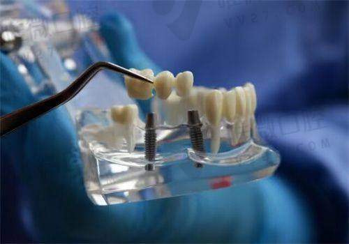 牙疼不是病,治起来“跳价”?这里不设套路